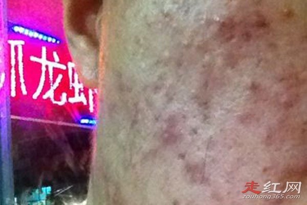 ����ָ������֥��Ů����ʲô��˼ �ֲ���Ƭ����p������