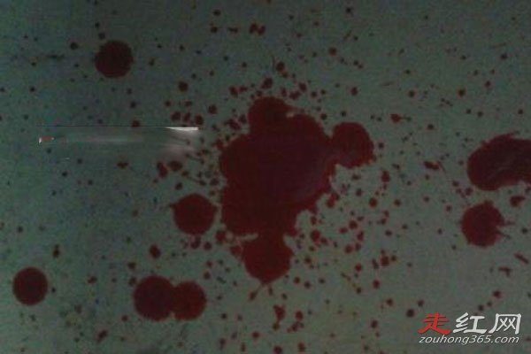 �ϴ���ʬ�������� ��ͼ�������ͼƬ��������