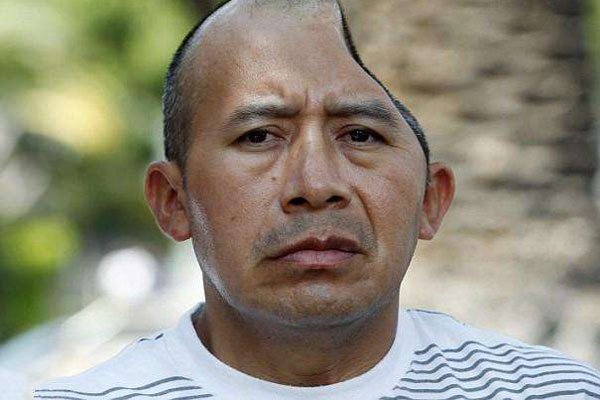 没有了半个脑子还是可以存活这样长时间,还是和正常人一样,对