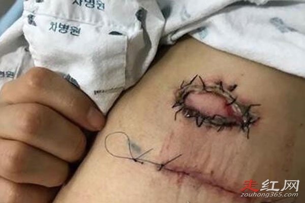 ����ɪҽ���¼� ������ţ����ô����