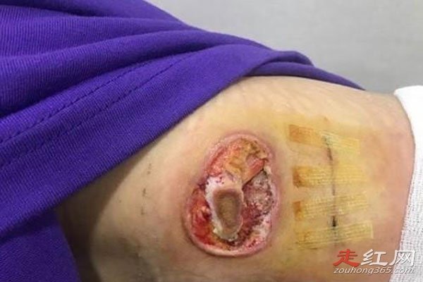 ����ɪҽ���¼� ������ţ����ô����