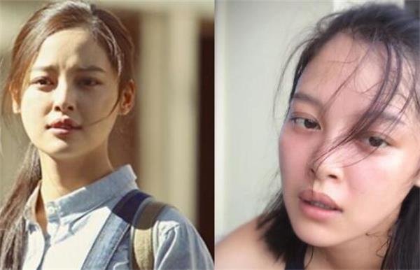 辛芷蕾的嘴唇唇裂怎么回事 和整容有关吗