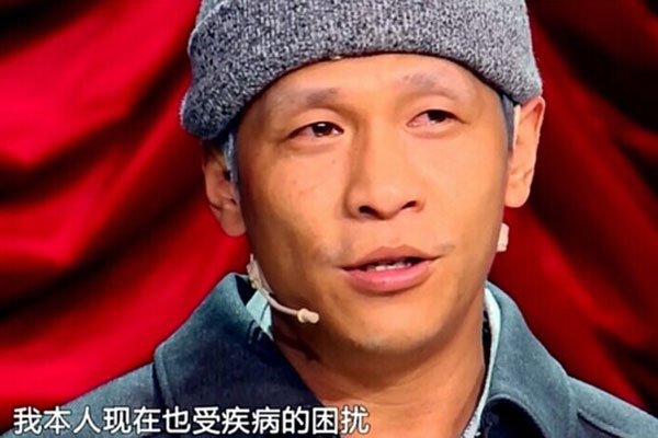 宋小宝肝硬化还活着吗肤色变黑与疾病有关