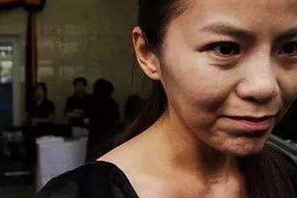 朱迅脖子上有疤痕吗 患上了甲状腺癌住院手术