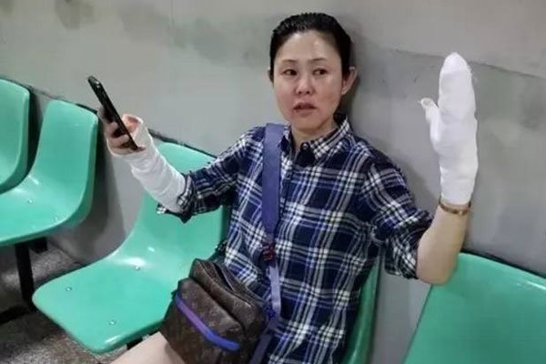 ѩ��������֮�ҷ��������̱�¶ �����Ų��������ķ���